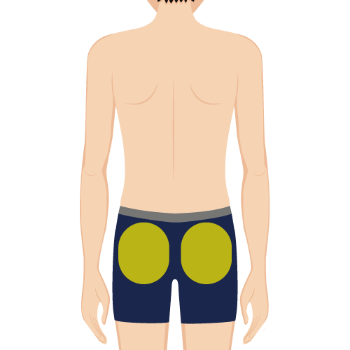 おしり照射範囲