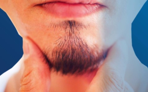 脱毛効果以外でヒゲが再び生えてくるケースもある