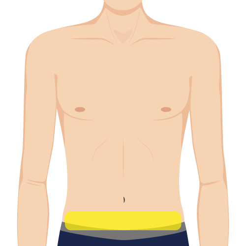 下腹部照射範囲